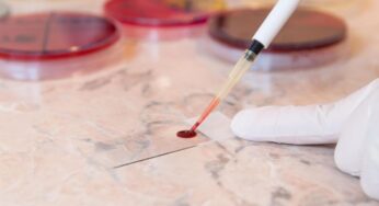 Un análisis rápido de sangre puede mejorar el tratamiento del accidente cerebrovascular